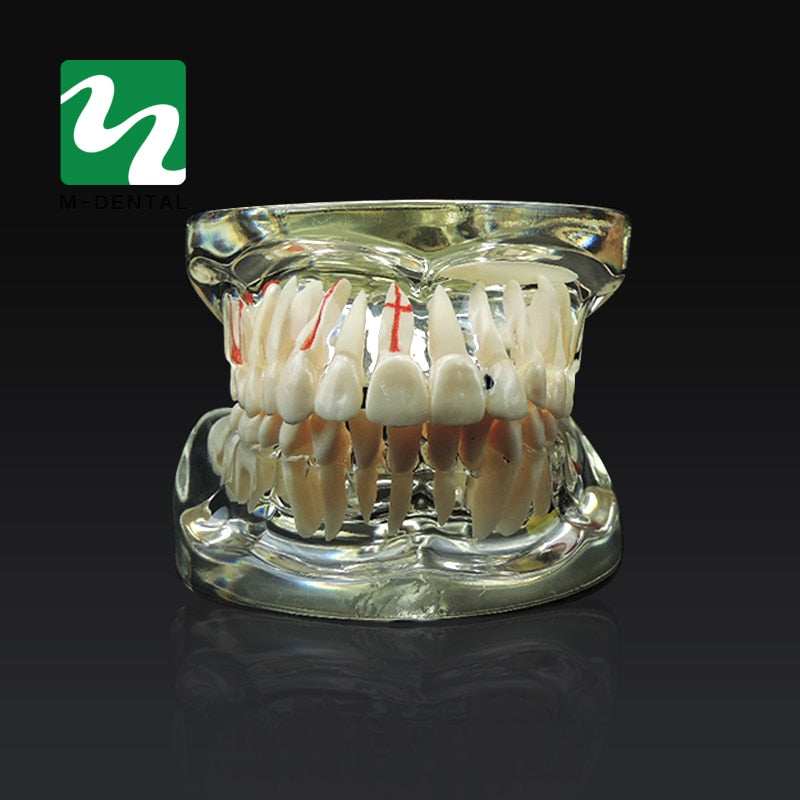 Dental Study Tooth