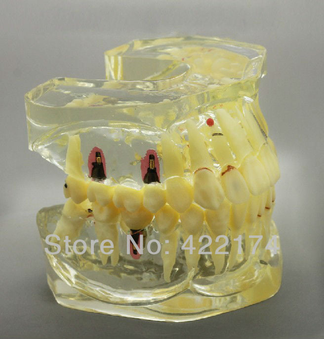Free Shipping Dental
