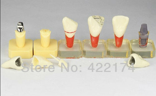 Free Shipping Dental