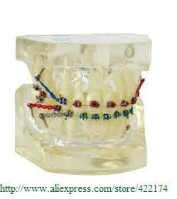 Free Shipping Orthodontics