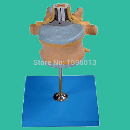 Lumbar Vertebra with