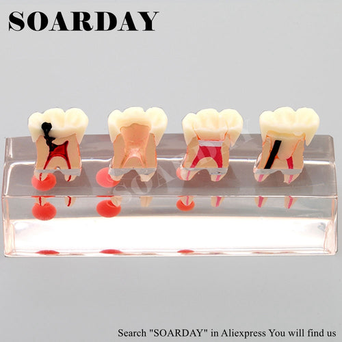 SOARDAY Dental Endodontic