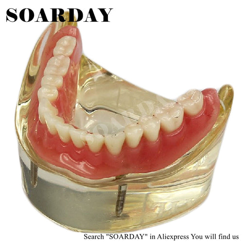 SOARDAY Dental Lower