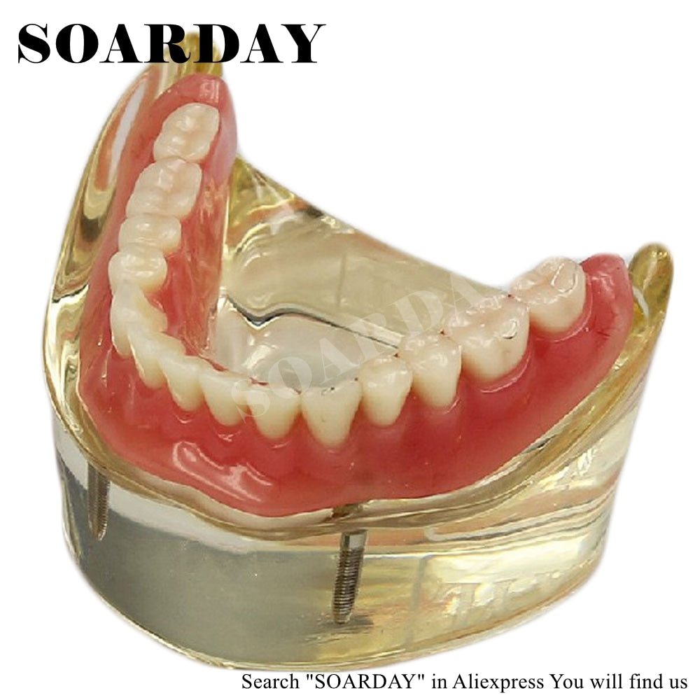 SOARDAY Dental Lower
