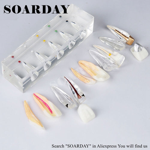 SOARDAY Endodontic Restoration