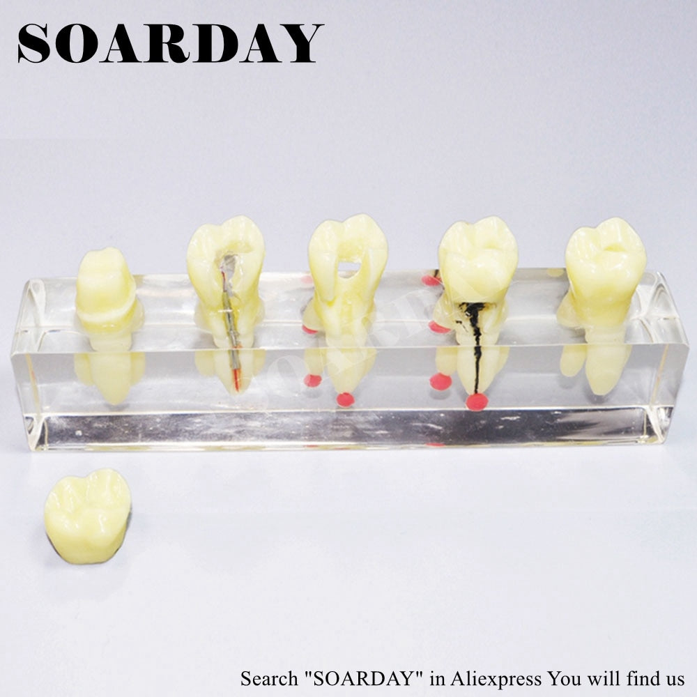 SOARDAY Tooth Root
